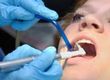 All About Cosmetic Dentistry Procedures