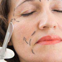 Face Lift Face Lift Surgery Types Of