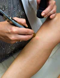 Hair Removal Laser Surgery Laser Surgery