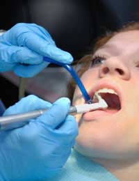 Cosmetic Dentistry Procedures Teeth